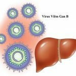 Bệnh viêm gan siêu vi B nguy hiểm như thế nào?
